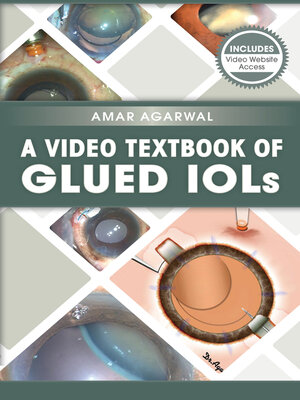 cover image of A Video Textbook of Glued IOLs